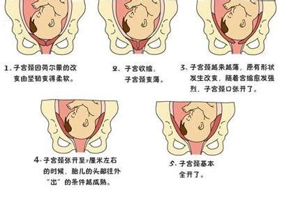 開三指意思|产前开三指——有哪些“不为人知的秘密”？